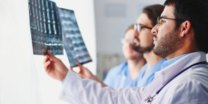 Three medical professionals look at X-ray scans, possibly considering the connection between testosterone and stroke recovery.